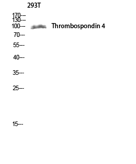IHC - Thrombospondin 4 Polyclonal Antibody AP72829